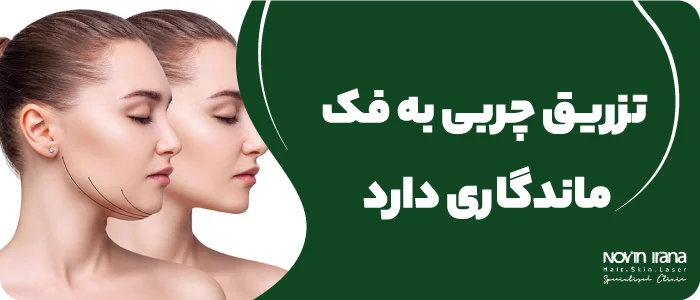 تزریق چربی به فک ماندگاری دارد؟
